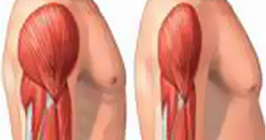 صورة هيئة الدواء المصرية تعلن تسجيل أول دواء لعلاج ضمور العضلات